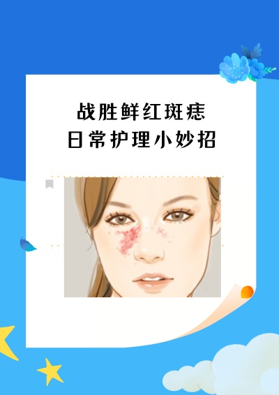 鲜红斑痣有什么危害吗？